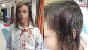 ילדים שהוכו על ידי שוטרים - 11.06.24