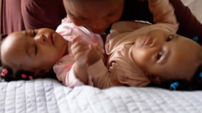 הופרדו (לא) בלידתן: תאומות סיאמיות הופרדו בהצלחה