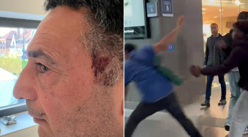 תיעוד: אב ישראלי ובתו הותקפו על ידי המון פרו-פלסטיני בבלגיה