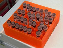 מחדל בדיקות הסרטן.כאן חדשות מחדל בדיקות הסרטן