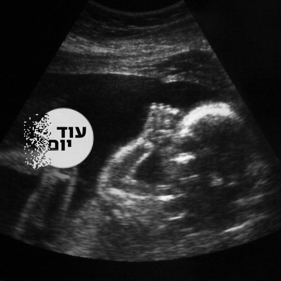 עובר.צילום: גטי אימאג'ס cat28755_img989258794.jpg