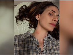 "זכיתי בלוטו": שירה הופיעה בטלוויזיה - הרופא אבחן דרך המסך גידול בצווארה