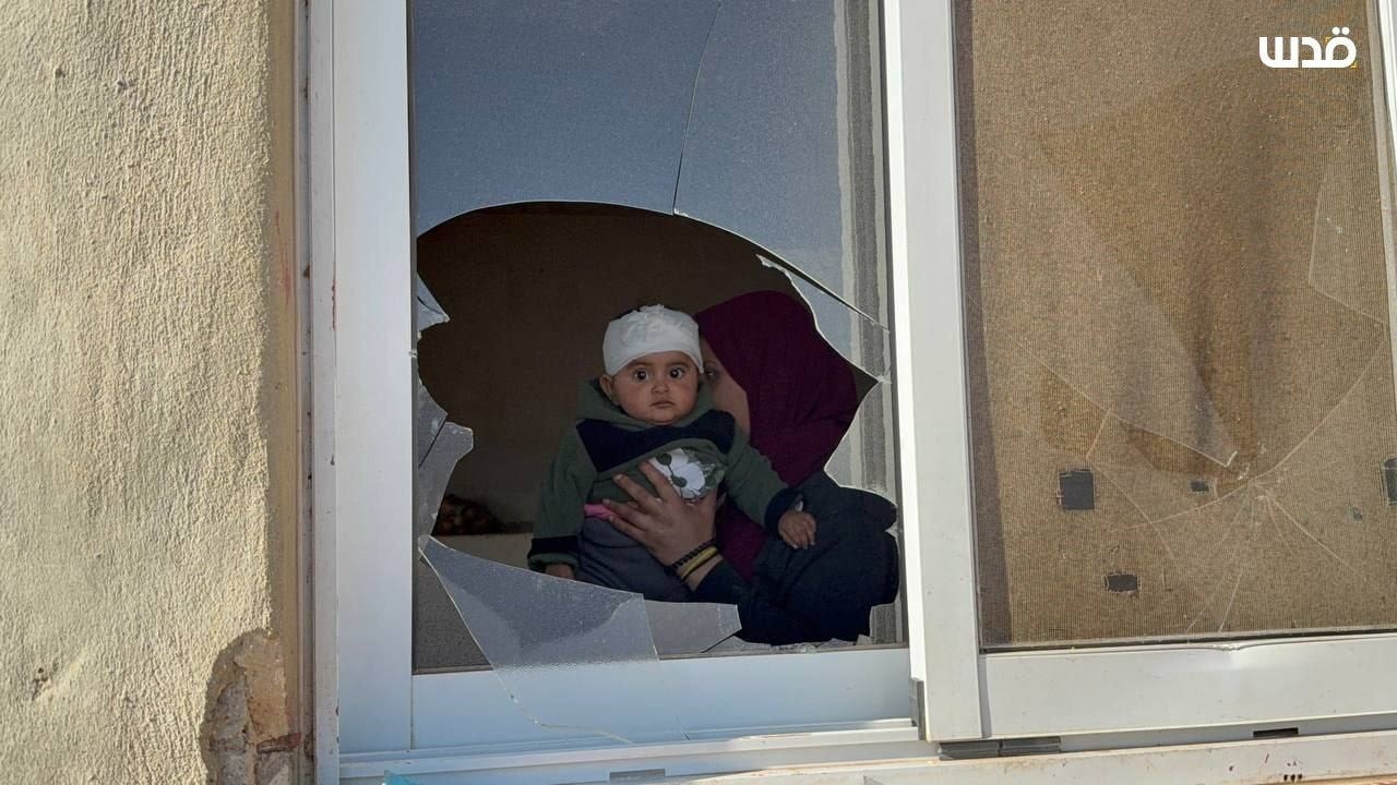 התינוקת שנפגעה בראשה בביתה