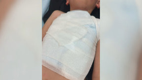 מזעזע: ילד בן ה-7 נפצע מזיקוק במשחק כדורגל
