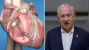 נתניהו והקוצב