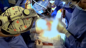 היסטוריה בסין: ריאה של חזיר הושתלה בגוף אדם